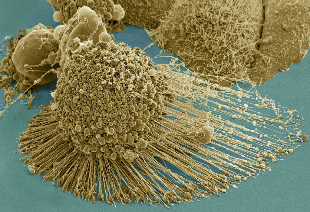 Найден способ положить конец «бессмертию» раковых клеток