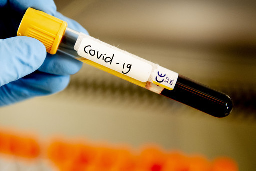 В России создали новый тест на COVID-19