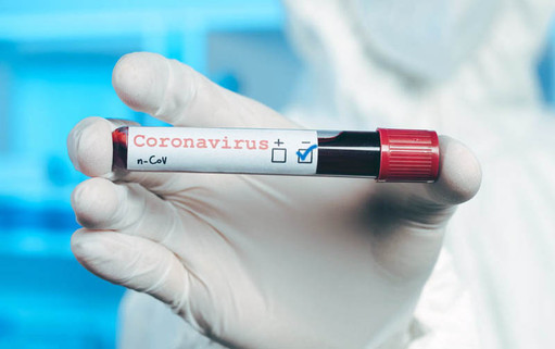 За сутки в ЧР коронавирусом заразились 20 человек