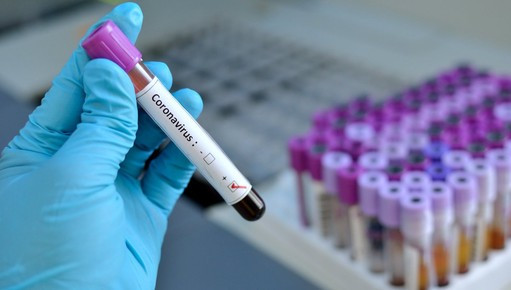 В Чеченской Республике выявлено 11 случаев заболевания COVID-19 за сутки