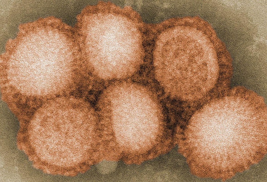 Птичий грипп: ждать ли новой пандемии?