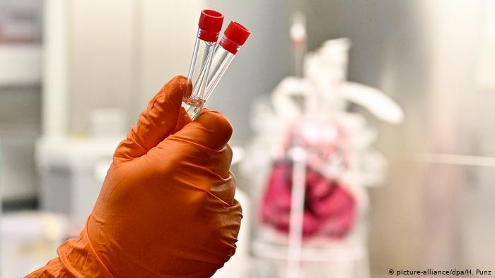 Разведка США не пришла к конкретным выводам о происхождении SARS-CoV-2