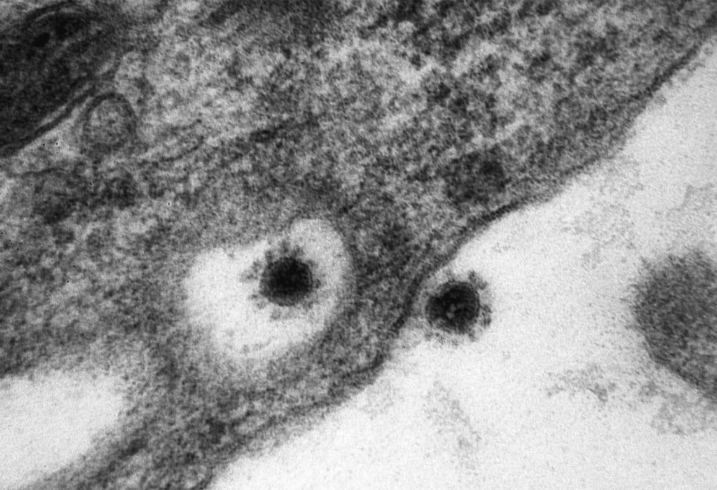 Одна разновидность коронавируса оказалась ответственной за 90 процентов заболеваний «дельтой» в России