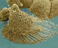 Найден способ положить конец «бессмертию» раковых клеток
