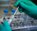 За последние трое суток в ЧР не зафиксировано новых случаев заражения коронавирусом