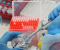 Количество заражённых коронавирусом в ЧР достигло 219 человек