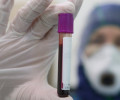 Названа возможная дата окончания пандемии коронавируса в России