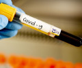 В России создали новый тест на COVID-19