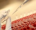 Росздравнадзор подтвердил неточность статистики смертей от COVID-19
