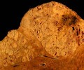 Ученые открыли новый биомаркер для диагностики рака печени