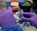 Российский инфекционист назвал возможное последствие мутации коронавируса