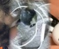 Опасно для жизни: взрыв Bluetooth-наушников во время работы убил человека