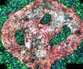 Израильские биологи распечатали раковую опухоль на 3D-принтере