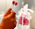 Разведка США не пришла к конкретным выводам о происхождении SARS-CoV-2