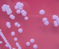 Американка подхватила тропическую инфекцию после чистки аквариума