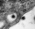 Одна разновидность коронавируса оказалась ответственной за 90 процентов заболеваний «дельтой» в России
