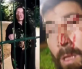 Напавшие с собаками на мусульманку с детьми в Москве атаковали ее мужа (видео)